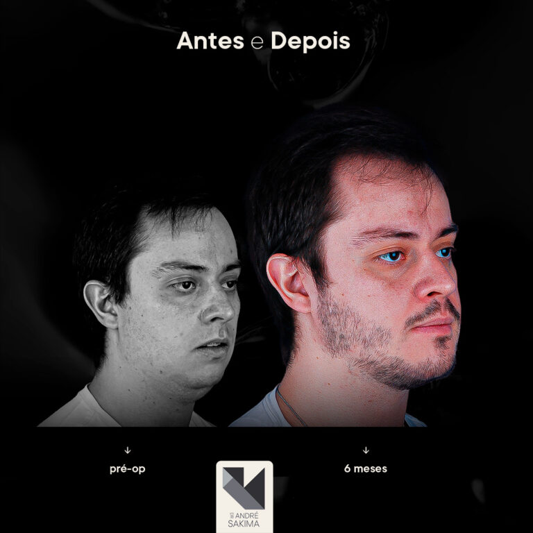 Dr-antes-e-depois-12_01