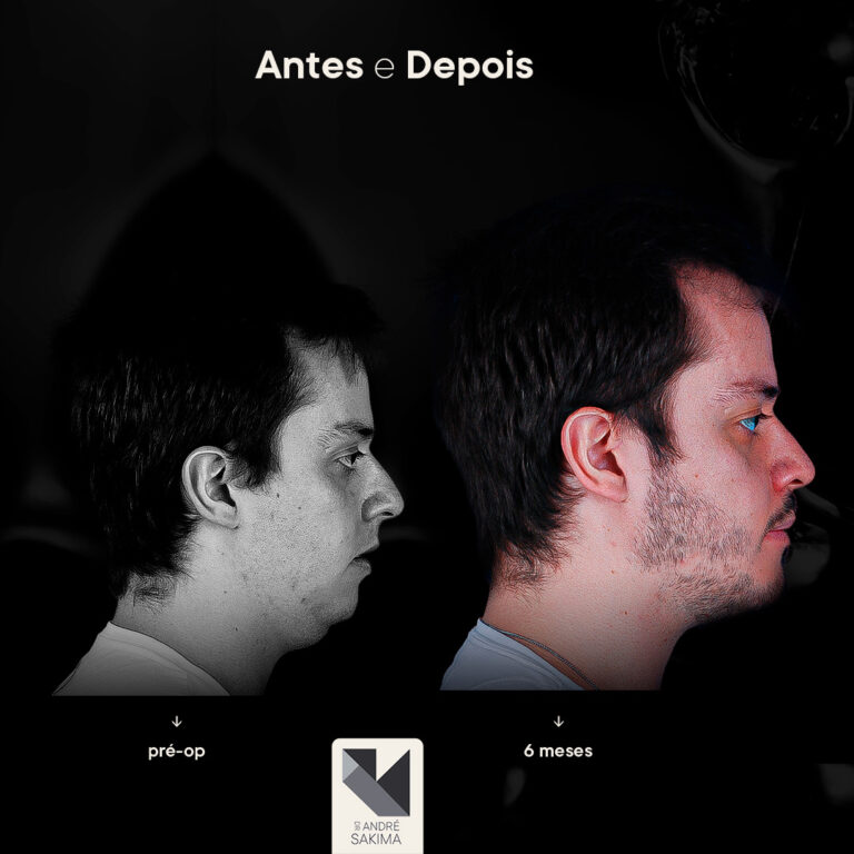 Dr-antes-e-depois-12_02
