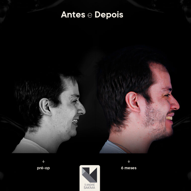 Dr-antes-e-depois-12_03