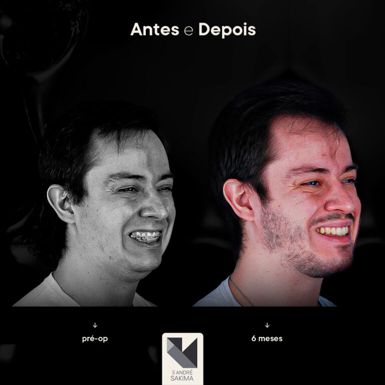 Dr-antes-e-depois-12_04
