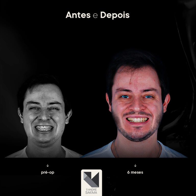 Dr-antes-e-depois-12_06