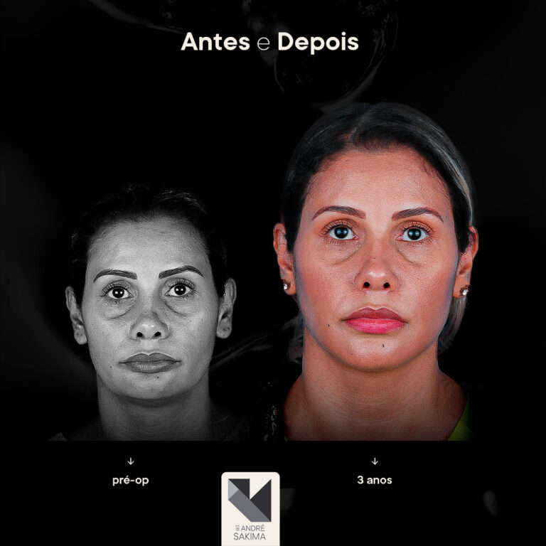 Dr-antes-e-depois-13_01