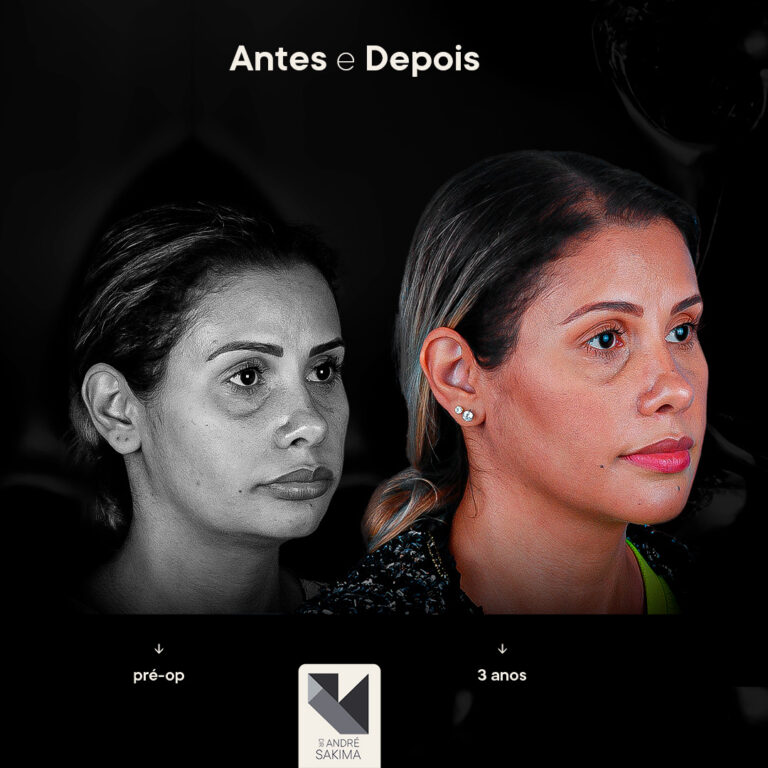 Dr-antes-e-depois-13_02