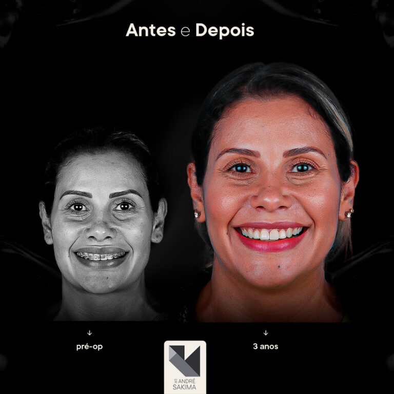 Dr-antes-e-depois-13_03