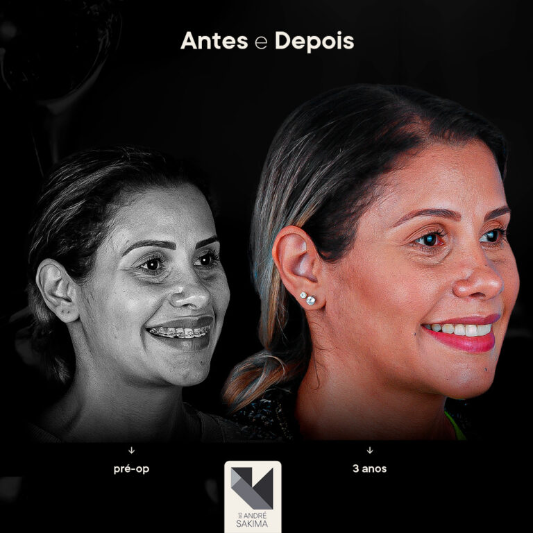 Dr-antes-e-depois-13_04