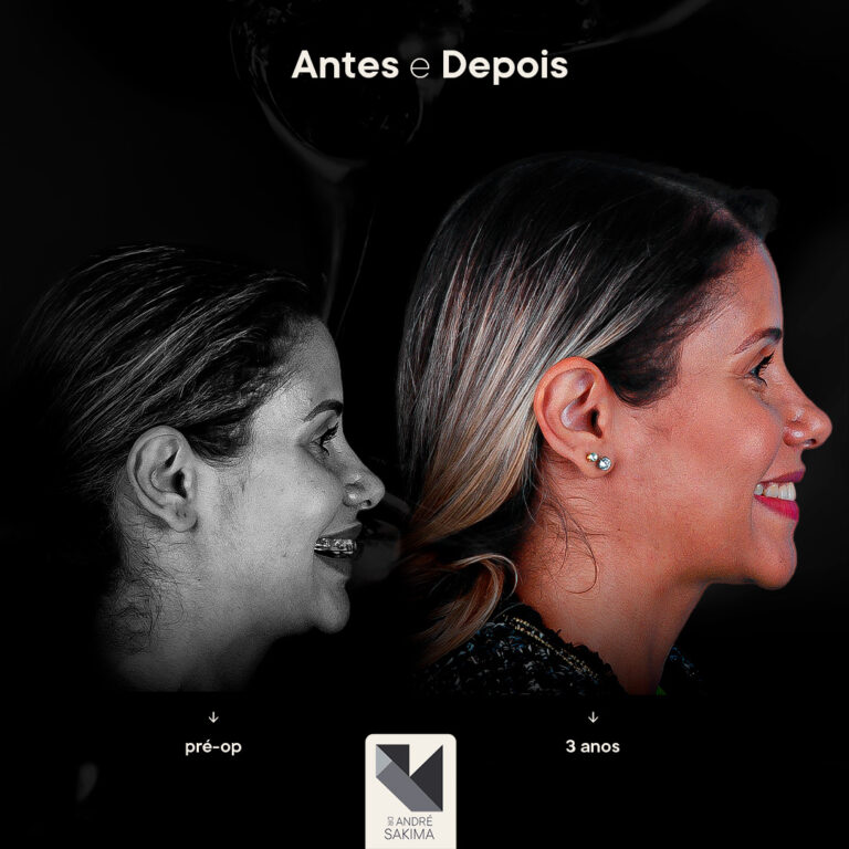 Dr-antes-e-depois-13_05