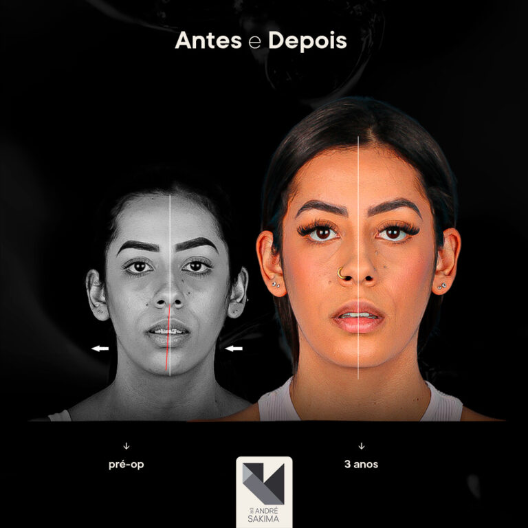 Dr-antes-e-depois-15_01