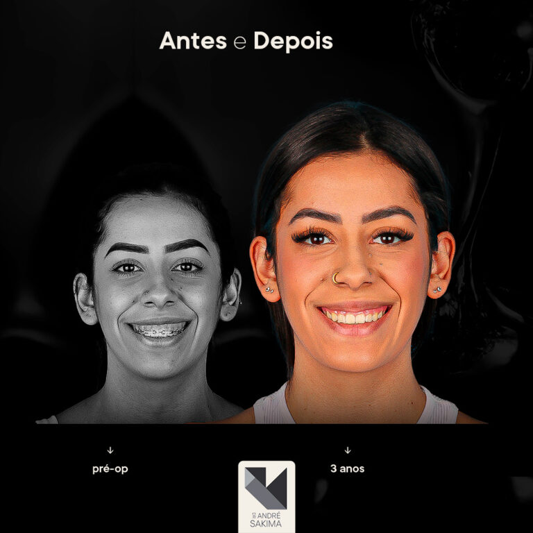 Dr-antes-e-depois-15_02