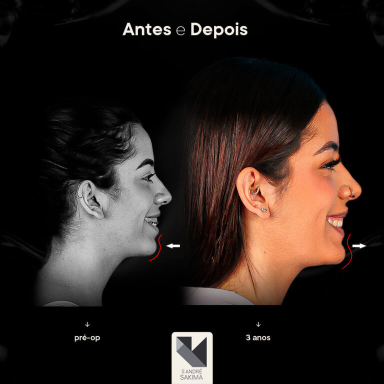 Dr-antes-e-depois-15_03