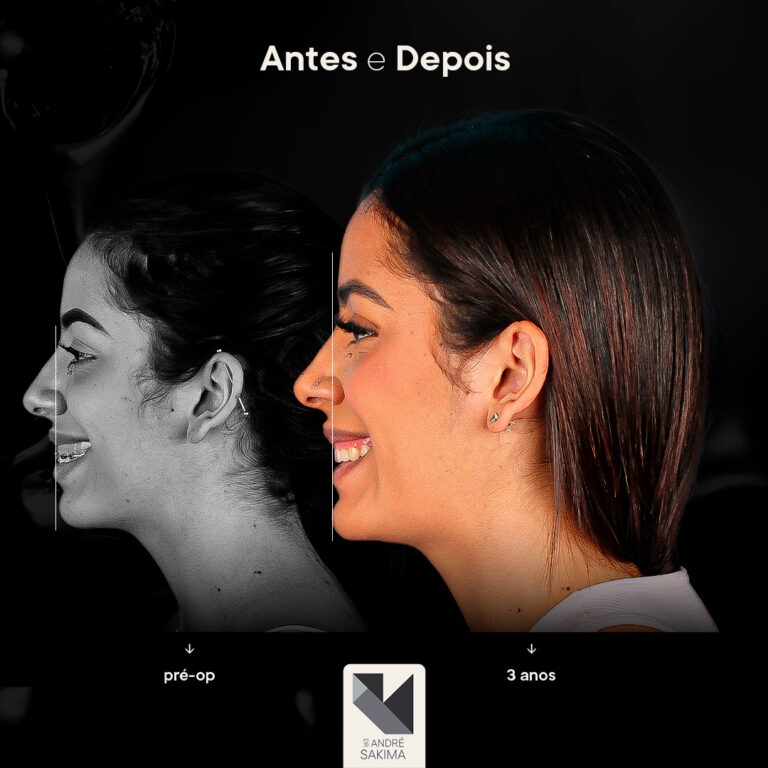 Dr-antes-e-depois-15_04