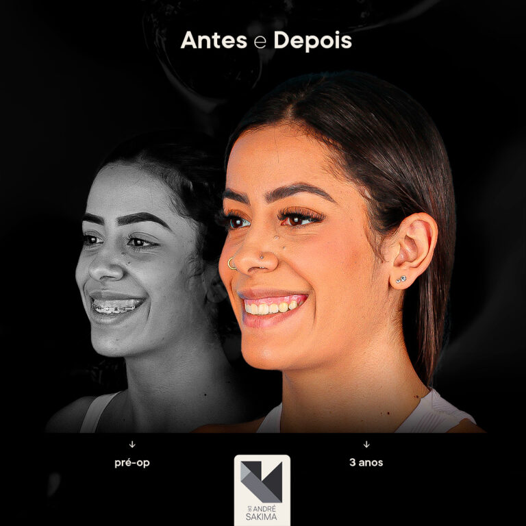 Dr-antes-e-depois-15_05
