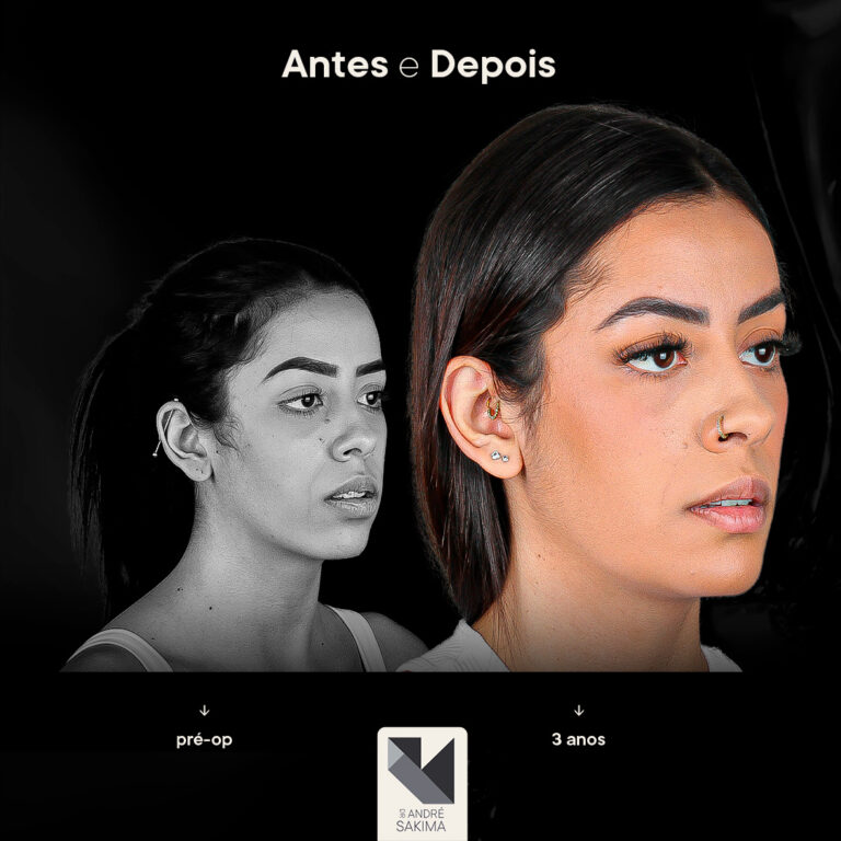 Dr-antes-e-depois-15_06