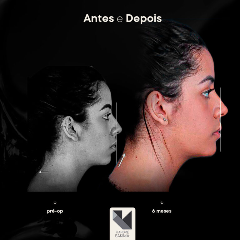 Dr-antes-e-depois-15_07