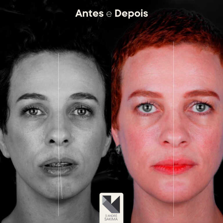 Dr-antes-e-depois-16_01