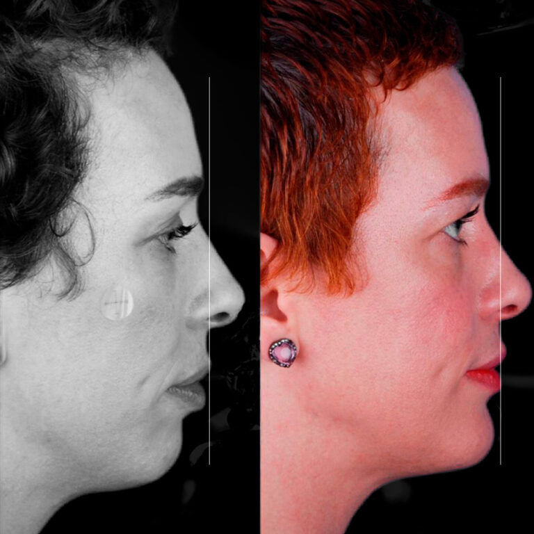 Dr-antes-e-depois-16_02