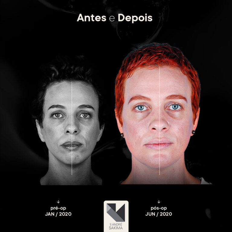 Dr-antes-e-depois-17_01