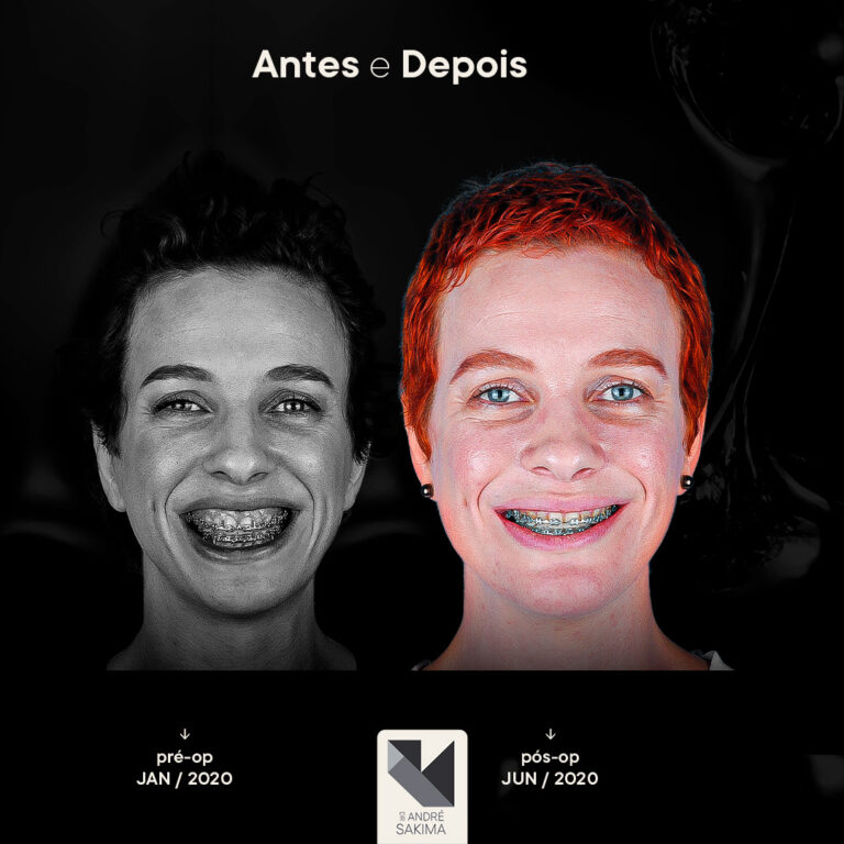 Dr-antes-e-depois-17_02