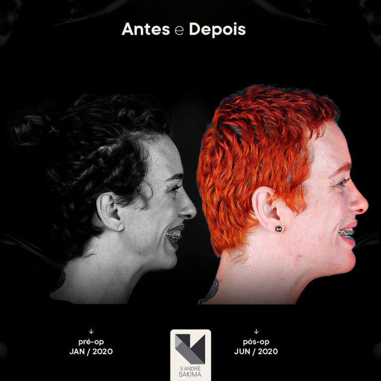 Dr-antes-e-depois-17_03