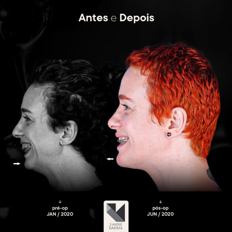 Dr-antes-e-depois-17_04