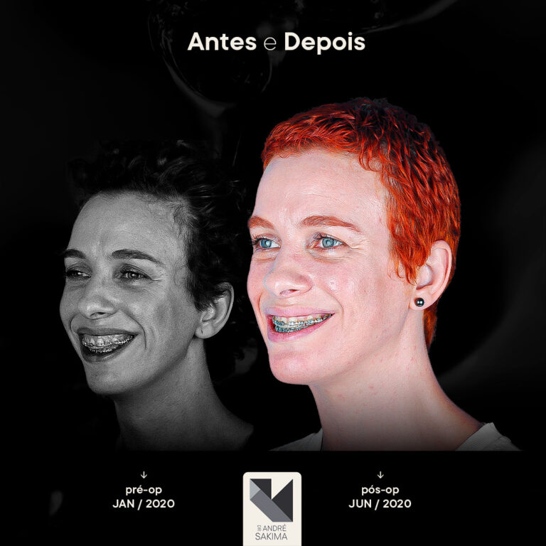 Dr-antes-e-depois-17_05