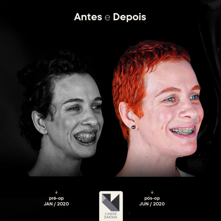 Dr-antes-e-depois-17_06