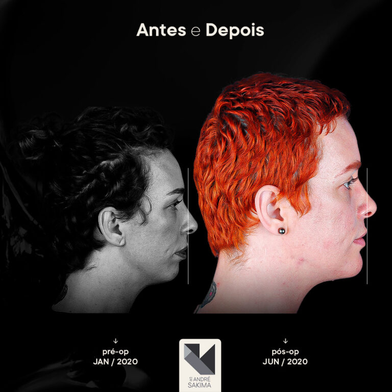 Dr-antes-e-depois-17_07