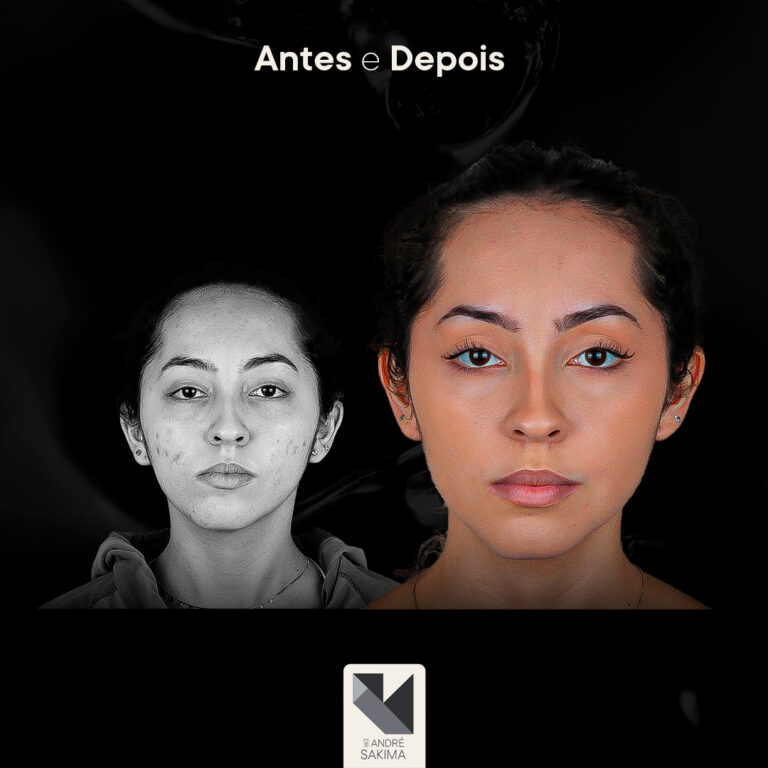 Dr-antes-e-depois-18_01