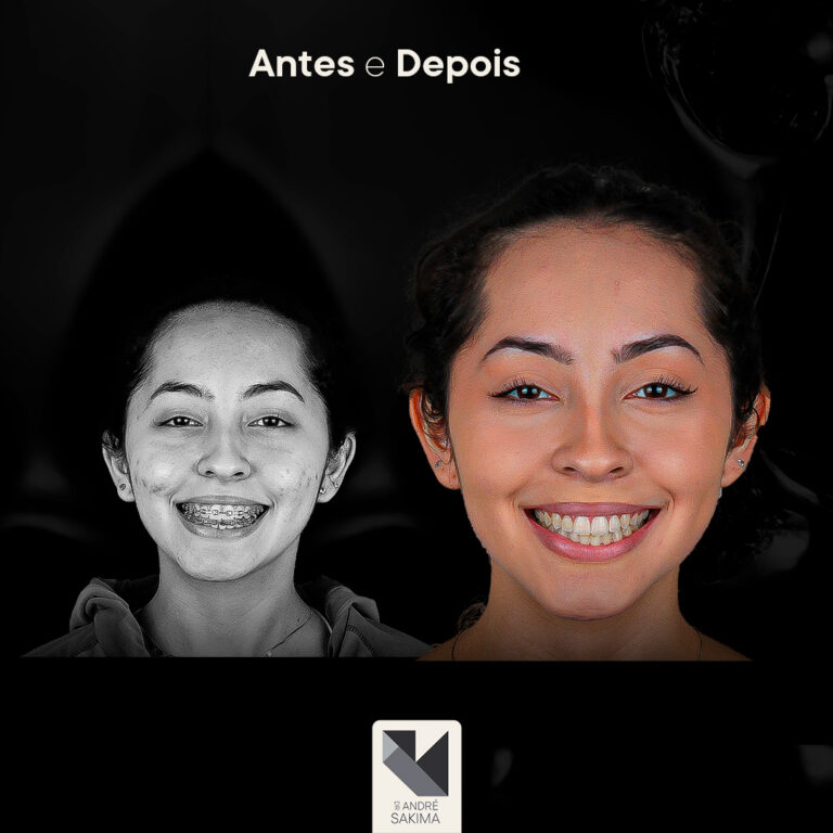 Dr-antes-e-depois-18_02