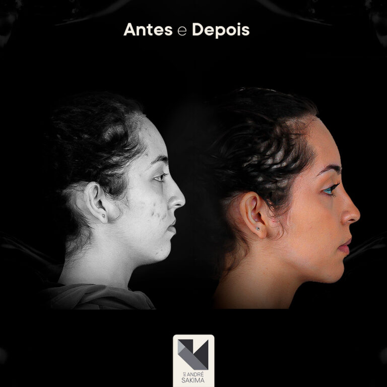 Dr-antes-e-depois-18_03