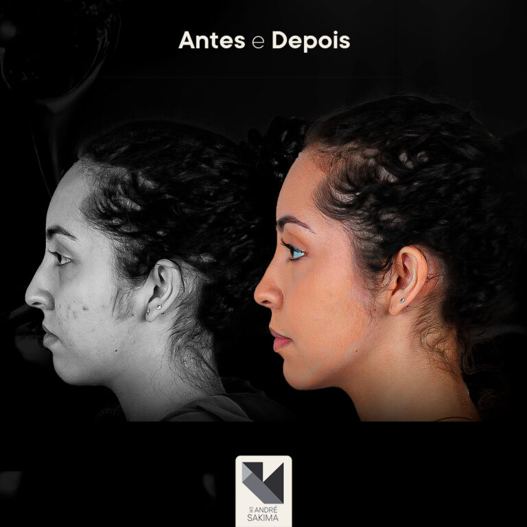 Dr-antes-e-depois-18_04
