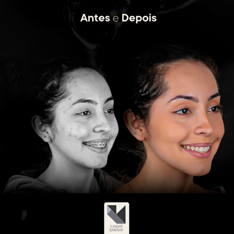 Dr-antes-e-depois-18_05