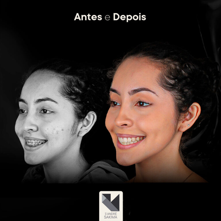 Dr-antes-e-depois-18_06