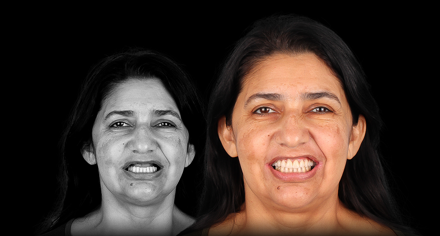 Antes e depois - Caso clínico 7