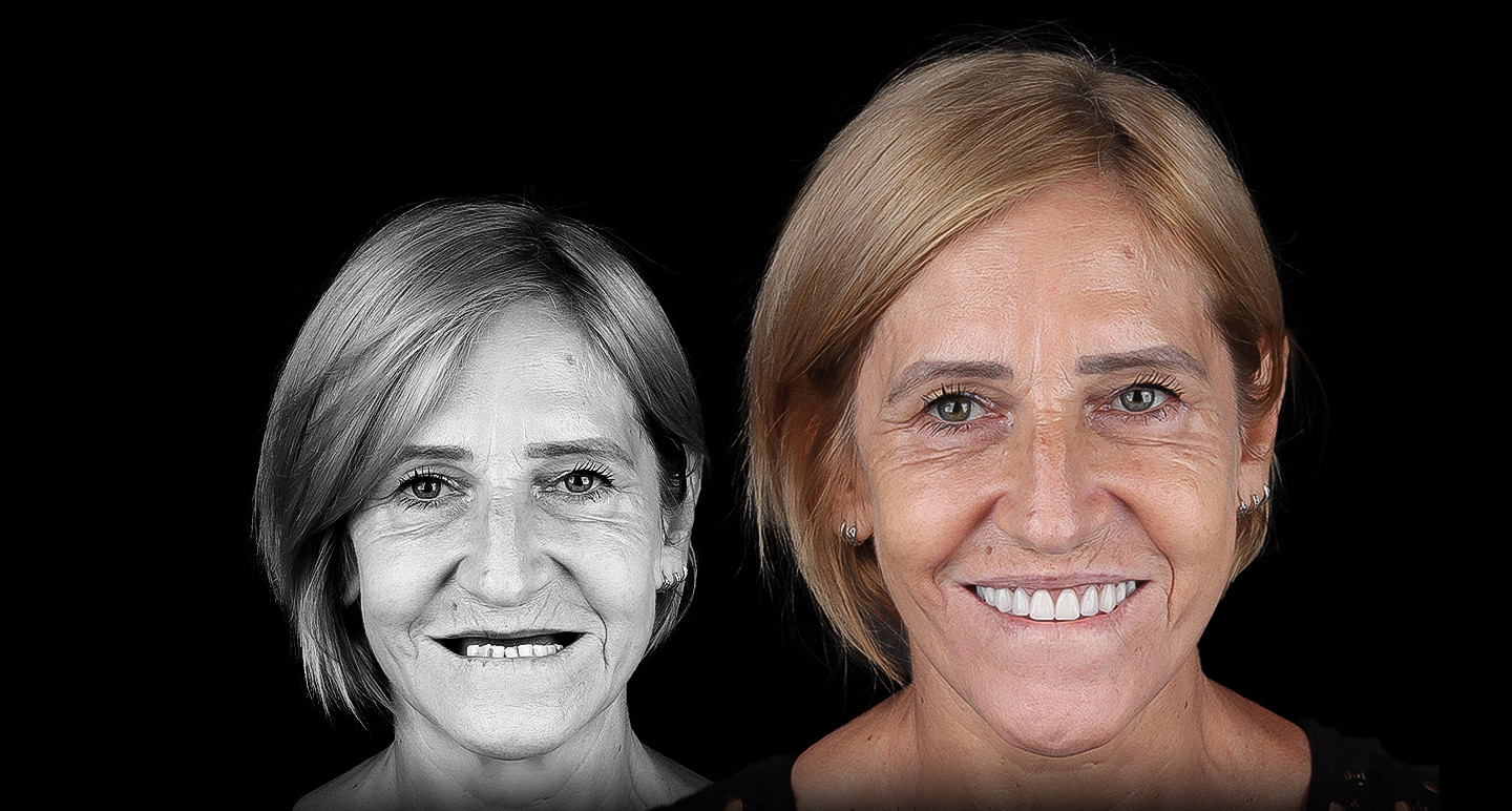 Antes e depois - Caso clínico 8
