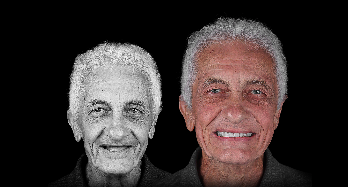 Antes e depois - Caso clínico 9