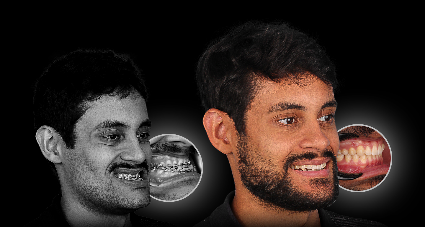 Antes e depois - Caso clínico 2