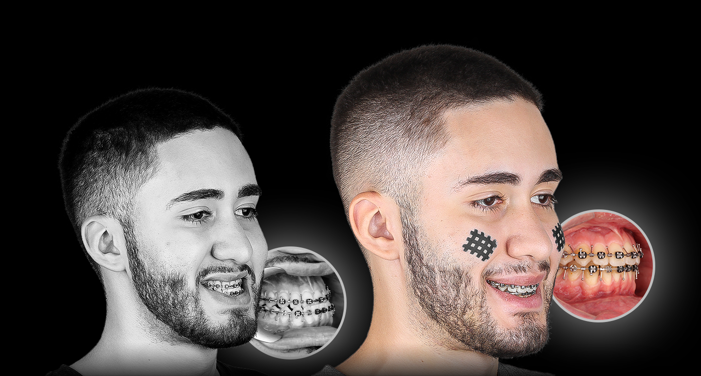 Antes e depois - Caso clínico 3