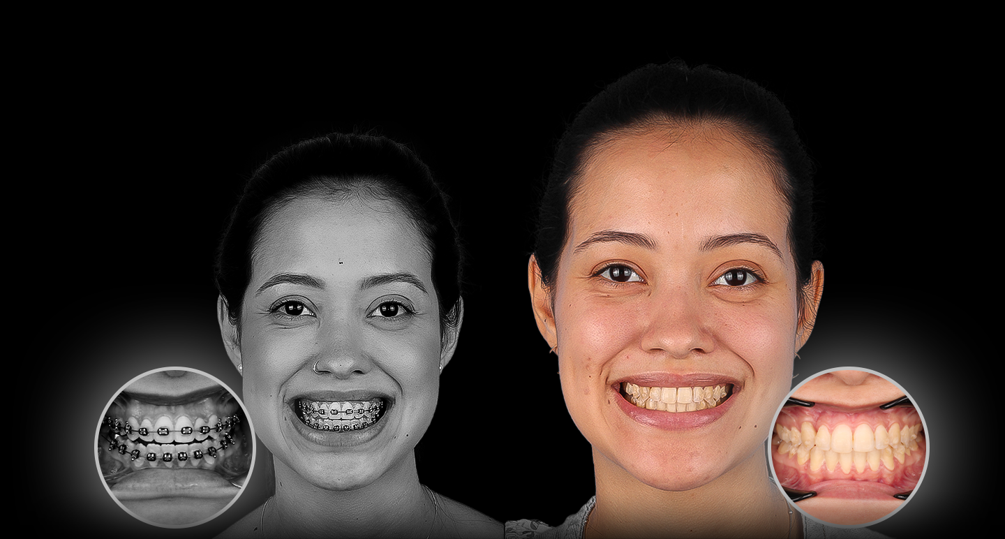 Antes e depois - Caso clínico 5