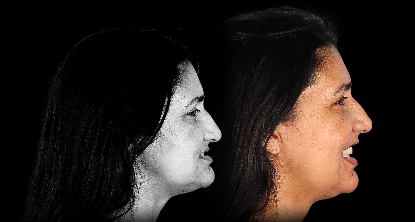 Antes e depois - Caso clínico 6